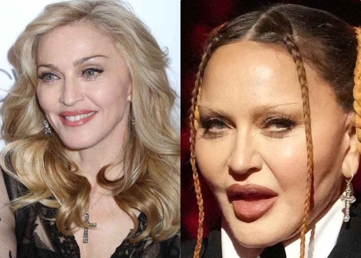 Madonna dice que quiere recuperar su rostro natural antes de salir de gira